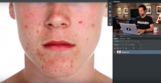 10 Minute Tutorial On How To Remove Acne From Your Portrait Images